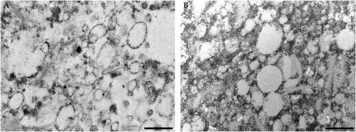 Figure 1. Ultrastructural analysis. Transmission electron microscopy images of BM-vesicles (A) and BM-vesicles with SFN (B). Scale bar = 500 nm.