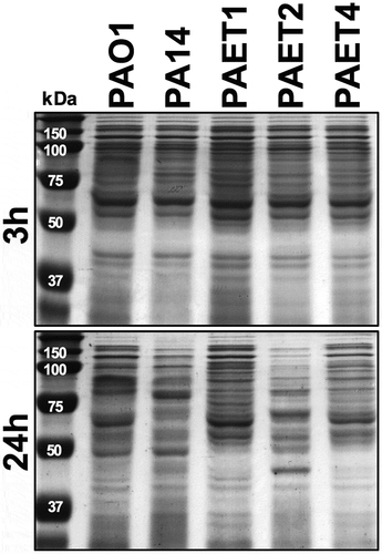 Figure 5. Shifting protein expression pattern among the reference and CF isolates of P. aeruginosa. The figure shows the picture of two SDS-PAGE gels with the protein extracts of the PAO1 and PA14 reference strains together with the PAET1, PAET2 and PAET4 CF-clinical isolates after 3 and 24 h of planktonic growth. While all P. aeruginosa strains shared similar protein pattern after 3 h of growth, it completely changed after 24 h, with a completely different protein expression profile between strains independently their background.