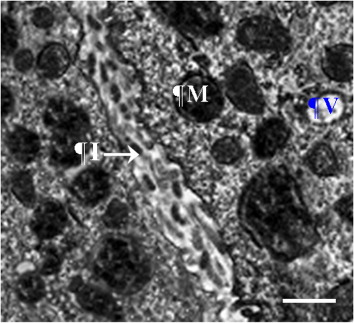 Figure 3. Transmission electron micrograph showing proximal tubules in domestic pigeon (Columba livia var. domestica). Note the intercellular space, which is occupied by interdigitations. I = interdigitation; M = mitochondrion; V = vesicle. Scale bar = 2 µm.