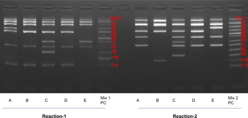 Figure 1 Representative phage-open reading frame typing electrophoretic profiles.Notes: Samples of DNA collected from patients were analyzed by PCR and electrophoresis according to the kit protocol provided by the manufacturer. Sample A (patient number 89, 122-137-80), sample B (patient number 90, 106-137-2), sample C (patient number 91, 106-157-116), sample D (patient number 51, 106-137-80), and sample E (patient number 52, 108-24-80), respectively. Positive control (PC) included in kit. Band size was estimated by positive control markers of mixtures 1 and 2, including fem A gene (601bp: Staphylococcus aureus specific gene).Abbreviation: PCR, polymerase chain reaction.