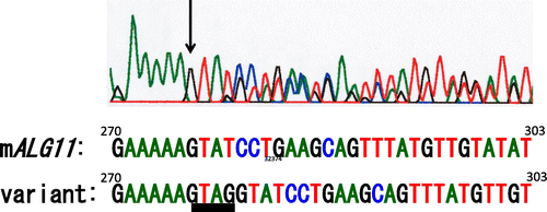 Fig. 3. Electropherogram of the ORF (270–303) of mALG11- and its variant-cDNA.Note: Black arrow indicates the site of GTAG insertion in the variant cDNA.
