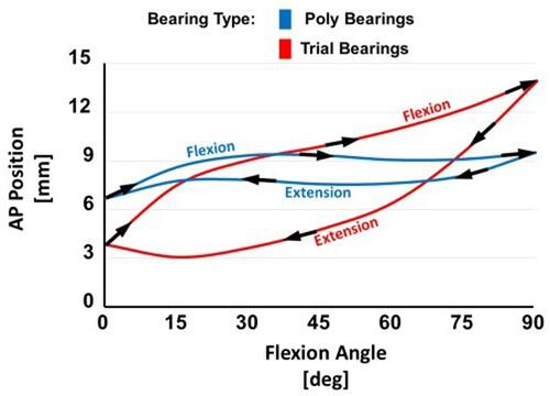 Figure 2 An illustration of hysteresis, which is the difference between the paths followed by the knee in flexion versus extension. The example shown includes flexion and extension paths for trial (red) and final (blue) tibial inserts.