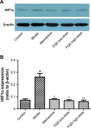 Figure 11 Effect of Fuzheng Quxie Decoction (FQD) on hypoxia-induced factor 1α (HIF1α) expression in brains of SAMP8 mice.