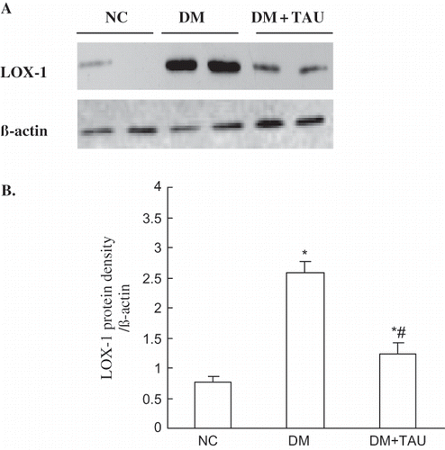 Figure 4. (A) Western blot analysis of LOX-1 protein, and (B) densitometric analysis in renal tissue in NC, DM, and DM  +  TAU groups. Values are the mean ± SEM. *p < 0.01 vs. NC, #p < 0.01 vs. DM.