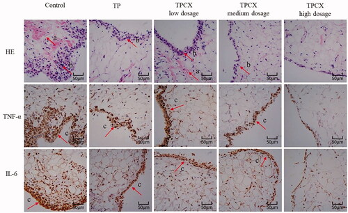 Figure 6. Histopathology and immunohistochemistry of TNF-α and IL-1β in rat synovium (a, pannus; b, synovial cell proliferation), triptolide (TP), triptolide phospholipid complex (TPCX).