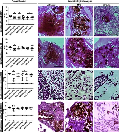 Figure 5 Fungal burden and histopathological analysis of Galleria mellonella larval tissue infected with yeasts and treated or not with free miltefosine (MFS) and miltefosine-loaded alginate nanoparticles (MFS.Alg). Fungal burden data is represented by the mean ± standard deviation. *P<0.05 and  **P<0.01 when compared with the untreated group (one-way ANOVA with Dunnet’s post-test). Fungal burden, filamentation and dissemination of yeasts in Galleria mellonella larvae were analyzed by visualization of larval tissue histological sections of larvae untreated, treated with MFS (40 mg/kg), or treated with MFS.Alg (200 mg/kg). Black arrows indicate yeasts and white arrows indicate C. albicans filamentation. Bars: 50 μm.