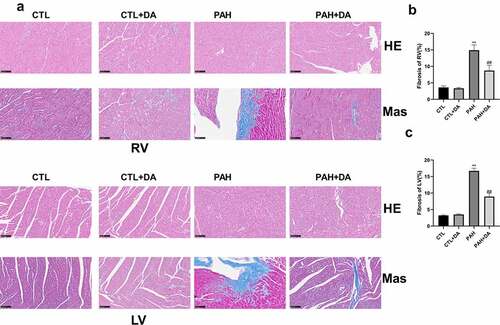 Figure 7. Effects of Dapagliflozin on the left ventricle and right ventricle. Representative results of HE and Masson staining (a). Quantitative results of Mas in right ventricle (b) and left ventricle (c) (n = 3 each group). Data are presented as mean as ±SEM. *P < 0.05 vs. CTL group, #P < 0.05 vs. PAH group. **P < 0.01 vs. CTL group, ##P < 0.01 vs. PAH group. Abbreviations: RV, right ventricle; LV, left ventricle.