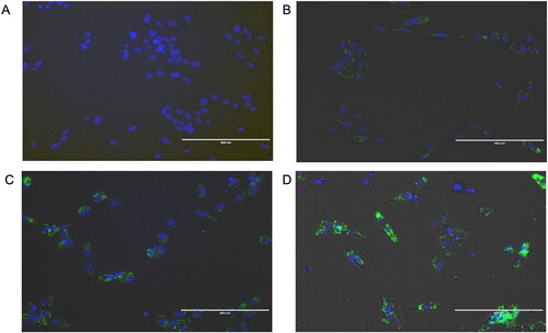 Figure 4. Uptake of EV labelled with PKH. EVs were derived from at-MSC preconditioned with TGFβ-1. Endometrial stromal cells were co-cultured with 1x1010 PKH-67 labelled EV for 48 h at 38.5 °C and visualized 24h later. Blue: nuclei stained with Nuc-Blue; green stained EVs with PKH-67 fluorescent dye. A) background control; B to D: internalization of EVs at time 0, 4 and 24h respectively.