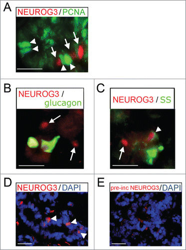 Figure 3. Immunofluoresence for NEUROG3 in human fetal pancreas. (A–E) Immunofluorescence for NEUROG3 at 14 wpc. (A) Arrowheads point to green PCNA-positive cells while arrows point to separate red NEUROG3-positive cells. (B) and (C) Arrows point to hormone-negative NEUROG3-positive cells. Arrowhead points to a very rare NEUROG3-positive cell with faint somatostatin (SS) staining. (D) and (E) Arrowheads point to NEUROG3-positive nuclei visible in (D) but not (E) following pre-incubation with full-length human NEUROG3 protein. Amplification of the red gain with DAPI counterstaining to investigate the loss of nuclear staining has introduced some background cytoplasmic staining. Scale bar represents 50 μm.