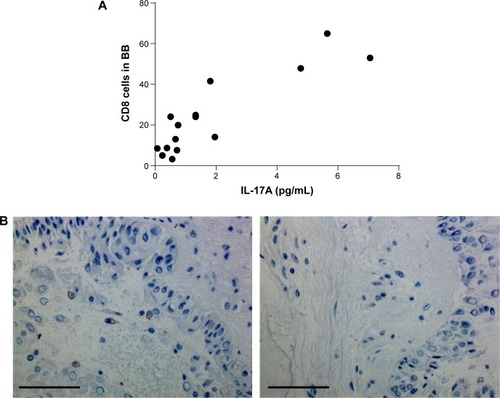 Figure 4 Immunohistochemical staining on biopsies from smokers.