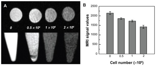 Figure 5 Magnetic resonance imaging of SPIO-labeled GFP-ADSCs in vitro. (A) Different cell populations labeled with SPIO were visible on T2-weighted images. (B) MRI signal intensity of labeled cells was inversely correlated with the number of labeled GFP-ADSCs in T2-weighted images in vitro.Abbreviations: GFP-ADSCs, green fluorescent protein adipose-derived stem cells; MRI, magnetic resonance imaging; SPIO, superparamagnetic iron oxide particles.