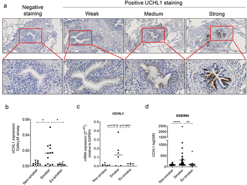 Figure 1. Smokers have more cells with strong-expressed UCHL1 than ex- and non-smokers. (a) Representative pictures of negative and positive UCHL1 staining in lung tissue. The positively stained UCHL1 cells in bronchial airways had either a weak, medium, or strong expression. (b) Quantification of manually counted cells with a strong expression of UCHL1 in airway epithelium of non-smokers (n = 10), smokers (n = 12), and ex-smokers (n = 12). Significance was analysed by nonparametric Mann-Whitney U-test. (c) mRNA expression of UCHL1 in total RNA isolated from non-smokers, smokers, and ex-smokers by LCM-collected epithelium (n = 6). Significance was analysed by one-way ANOVA. (d) UCHL1 mRNA expression was increased in current smokers from GEO dataset. UCHL1 expression was measured by microarray through brushing from intra-pulmonary airways (the right upper lobe carina) and scrapings from the buccal mucosa, which is from smoking and non-smoking volunteers (including 34 smokers, 23 non-smokers, and 18 ex-smokers). Gene expression is shown as log2 (MI). Significance was analysed by nonparametric Mann-Whitney U-test. *p < 0.05, **p < 0.01, ****p < 0.0001. Abbreviations: MI, Microarray Intensity.