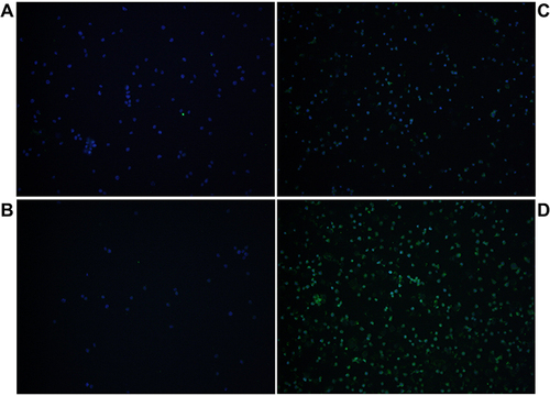 Figure 4 miR-31-5p negatively regulates IRF5 phosphorylation. CAL-1 cells were transfected with mimics control (A), miR-31-5p mimics (C), inhibitor control (B) or miR-31-5p inhibitor (D), and then stimulated with R848 (5µg/mL) for 4h. Then, the cells were stained with anti-phospho-IRF5 antibody and incubated with Alexa Fluor 488 goat anti-rabbit IgG (green). DAPI was used to stain the nuclei (blue). The images were captured with a laser confocal microscope.