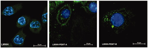 Figure 2. CLSM images showing macrophages with stained nuclei after 2 h incubation with fluorescein labeled LMWH or LMWH-NP.