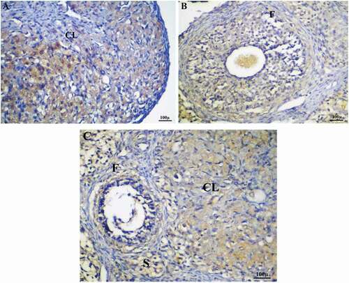 Figure 9. Immunohistochemistry showing caspase-3 streptavidin-biotin- peroxidase staining method in ovarian tissue of control adult female rat showing normal expression of immune stain caspase-3.