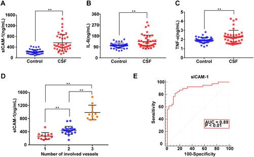 Figure 1 Relationship between plasma inflammation-associated biomarkers and coronary slow flow (CSF). (A) Plasma sICAM-1 levels were significantly higher in patients with CSF than in controls. (B) Plasma IL-6 levels were significantly higher in patients with CSF. (C) Plasma TNF-α levels were significantly higher in patients with CSF. (D) Correlation between the number of coronary arteries involved in CSF and plasma sICAM-1 level. (E) Receiver-operating characteristic (ROC) curve analysis of plasma sICAM-1 for diagnosing CSF; Data were analysed using Student’s t-test (A–C); one-way ANOVA for pairwise comparisons or comparisons between multiple groups with a single variable (D). Data represent the mean ± SD, **P < 0.01 vs Control group.