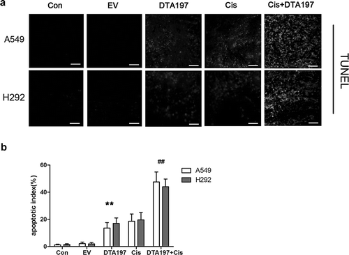 Figure 6. TUNEL staining of the xenografted tumor. (a). Representative fields of the TUNEL staining. (b). The Adsur-DTA197-treated mice showed more apoptotic cells in comparison with the mice treated with empty viruses (**p < .01). In comparison with the cisplatin treatment, the cisplatin combined with Adsur-DTA197 treatment caused more apoptotic cells (##p < .01). Scale bar, 50 µm