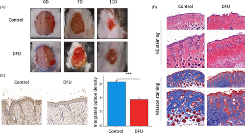 Figure 9 Animal experimental validation. (A) Optical pictures of the wound closure rate in the Control group and DFU group at days 0, 7, and 11 after the skin operation; (B) H&E and Masson staining images of wound tissues in the Control group and DFU group at day 7; (C) Representative images of immunohistochemical staining of GSTM5.