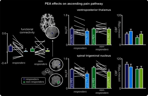 Figure 3 Effects of palmitoylethanolamide (PEA) on ascending pain pathway. To the right are plots of mean (±SEM) fractional amplitude of low-frequency fluctuations (fALFF) and cerebral blood flow (CBF) in responders (blue) and non-responders (green), pre- and post-PEA treatment. Individual subject values pre- and post-PEA are indicated in the fALFF plots by the white lines between the colored bars indicating the mean (±SEM). Note that both the responders and non-responders have a significant reduction in infra-slow oscillations in the spinal trigeminal nucleus, but only the responders have a decrease in the ventroposterior thalamus. In contrast, there are no changes in CBF. The regions in which fALFF decreases as a consequence of PEA treatment are color coded blue (responders) and green (non-responders) and overlaid onto axial T1-weighted anatomical slices. To the left of these overlays are plots of mean (±SEM) resting functional connectivity between the spinal trigeminal nucleus and ventroposterior thalamus. Individual subject values pre- and post-PEA are indicated in the functional connectivity plots by the white lines between the colored bars. Note that functional connectivity decreases significantly following PEA treatment in the responders only. *p<0.05 derived from voxel-by-voxel analysis; #p<0.05 derived from two-sample t-test.