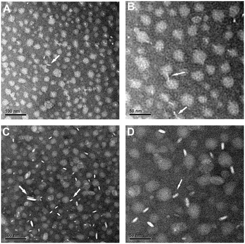 Figure 2 Electron micrographs of negatively stained Gd-chol-HDL (A and B) and Gd-(chol)2-HDL (C and D).Notes: Both samples were stained with 1% sodium phosphotungstate. White arrows indicate that the morphology of Gd-chol-HDL and Gd-(chol)2-HDL are discoidal nanoparticles. Original magnifications: (A and C) 30,000×, bar = 100 nm; (B and D) 60,000×, bar = 50 nm.Abbreviations: Gd, gadolinium; chol, cholesterol; HDL, high-density lipoprotein; DTPA, diethylenetriamine penta-acetic acid.