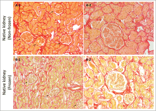 Figure 8. Sirius red stain imaging representative of general collagen for frozen/thawed and non-frozen native kidney samples at 10X (A-1 & B-1) and 20X (A-2 & B-2) magnifications. General collagen appeared to be partially damaged through freezing/thawing as evidenced by decreased stain color in frozen/thawed samples, which was detected as lighter colors. Void spaces were more detectable in frozen/thawed samples, which was again indicative of fibril damage and less integrity (arrows show renal corpuscles).