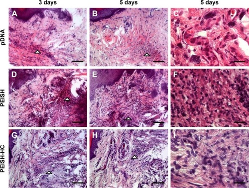 Figure 4 Inflammatory response in the injection site.Notes: Representative images of footpad subcutaneous tissue at 3 days (A, D, and G, scale bars =100 µm) and 5 days (B, E, and H, scale bars =100 µm; and C, F, and I, scale bars =20 µm) post-administration of naked pDNA (A–C), PEISH nanoparticles (D–F) or PEISH-HC nanoparticles (G–I). Arrowheads indicate the presence of infiltrating inflammatory cells.Abbreviations: pDNA, plasmid DNA; PEISH, thiolated poly(ethylene imine); HC, carboxylic fragment of tetanus toxin.