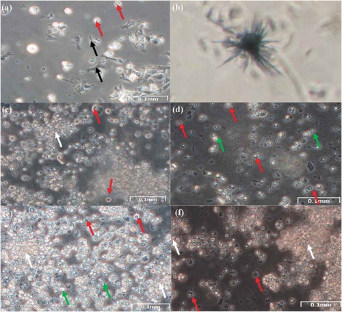 Figure 1. Gill cells. (a) Explant of gills from the Manila clam after 4 days in culture showing migration of fibroblast-like (black arrow) and oval-shaped cells cells (red arrow) (Quinn et al. Citation2009). (b) Formazan crystals formed with gill cells after 3 weeks in culture. These crystals formed after 72 h of incubation with MTT and dissolved with SDS. (c) Explant of gills after 4 days in culture showing migration of explant cell (white arrow) and oval-shaped cells (red arrow). These cells were visible in culture around the tissue in the first days, and after the explants were removed they increased in number. (d) Example of dissociated gill cells after 4 days in culture; oval-shaped cells (red arrow) and suspended cells (green arrow). (e) Cells from gill explant after 2 weeks in culture; (f) after 4 weeks in culture. Clusters of cells suggesting proliferation (white arrow), oval-shaped cells (red arrow), and suspended cells (green arrow)