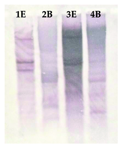 Figure 6. Southern hybridization analysis of genomic DNA from C. olitorius (Lane 1E and 2B) and C. trilocularis (Lane 3E and 4B) digested with EcoR I (E) and BamH I (B).