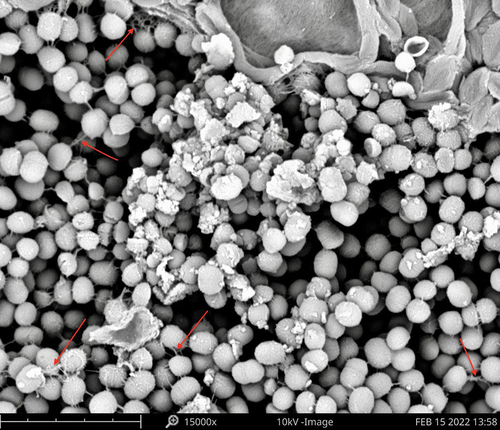 Figure 1. Scanning electron microscopy of lacrimal sac biopsies revealed structures consistent with extracellular material (red arrows) adjacent to the bacterial colonies, indicating biofilm formation.