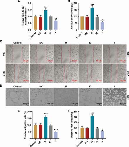 Figure 4. MiR-17-5p regulated the viability, migration, and tube formation of EPCs. (a) The transfection efficiency of miR-17-5p was evaluated using qPCR, with U6 as an internal control. (b) The viability of EPCs transfected with miR-17-5p mimic and inhibitor was detected by MTT assays. (c-e) The migration ability of EPCs transfected with miR-17-5p mimic and inhibitor was detected by wound healing assays (magnification ×100). (d-f) The tube formation ability of EPCs transfected with miR-17-5p mimic and inhibitor was detected by tube formation assays (magnification ×100). (***P < 0.001, vs. MC; ^P < 0.05, ^^^P < 0.001, vs. IC) (EPCs: endothelial progenitor cells, M: miR-17-5p mimic, I: miR-17-5p inhibitor, MC: mimic control, IC; inhibitor control)