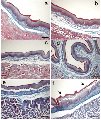 Figure 2. Microphotographs of esophageal epithelium (Masson Trichrome stained cross sections) exposed to different hyperthermic dosage: (a) 37°C × 60 s (i.e. control), (b) 40°C × 30 s, (c) 50°C × 30 s, (d) 60°C × 30 s, (e) 60°C × 90s, (f) 70°C × 30 s. Note that there were no alterations until thermal level of 60°C. These alterations mainly consisted of detachment of the epithelium at the level of the basal layer and tearing of upper layers (arrows). Bar: 100 µm.