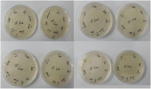 Figure 7 Antibacterial activity of La3+/α-Al2O3 nanocomposites against 4 gram-negative and 3 gram-positive bacteria. Different serial dilutions were 64 (plate1), 32 (plate 2), 16 (plate 3), 8 (plate 4), 4 (plate 5), 2 (plate 6), 1 (plate 7) and 0.5 (plate 8) μg/mL of the La3+/α-Al2O3 nanocomposites which added to the Mueller-Hinton agar medium.