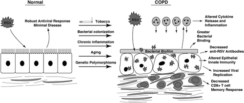 Figure 1 Potential differences in pulmonary defense against RSV in COPD patients. Factors that include age, environmental exposures, genetics, COPD itself (e.g., bacterial colonization, chronic inflammation), or a combination of these may alter the host response to RSV thereby increasing susceptibility to or severity of infection. Altered defense responses include antiviral innate and adaptive immunity, as well as inflammation that may lead to AECOPD.