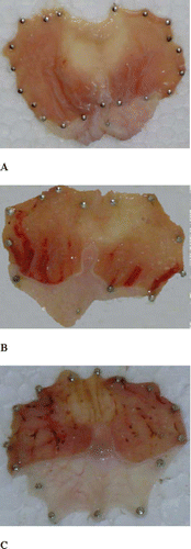 Figure 1 Gross anatomy of gastric mucosa: (A) normal rat, (B) EtOH-treated rat, and (C) indomethacin-treated rat.