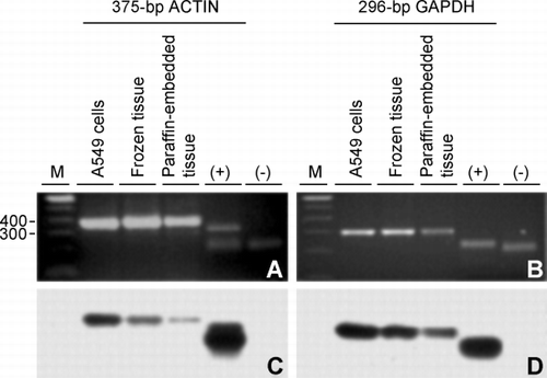 Figure 3. Confirmation of RT‐PCR products by Southern hybridization. (A) Agarose gel of the 375‐bp actin RT‐PCR product amplified from RNA extracted from A549 cells, frozen lung tissue and paraffin‐embedded lung tissue and, as positive and negative controls of hybridization, a partial restriction digest of pBS‐actin (lane +) and the purified restriction fragment carrying the sequence confirmed glyceraldehyde 3‐phosphate dehydrogenase (GAPDH) cDNA from pBS‐GAPDH (lane −), respectively. (B) Same as in A except the 296‐bp GAPDH product was amplified and controls are the GAPDH cDNA from pBS‐GAPDH (lane +) and the purified restriction fragment carrying the sequence confirmed actin cDNA from pBS‐actin (lane −). (C) Film detecting chemiluminescence after Southern transfer of (A) and hybridization with the actin cDNA from pBS‐actin used above. (D) Same as in (C) except the gel in (B) was transferred followed by hybridization with cDNA from pBS‐GAPDH used above. Lane M is a 100‐bp DNA ladder with bp sizes indicated at the left of (A).