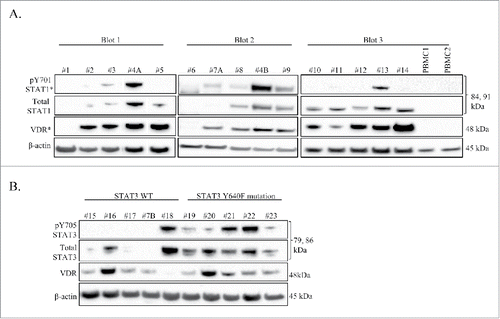 Figure 1. VDR and STAT are detectable in LGLL PBMC patient samples. Western blot analysis was performed on cryo-stored T-LGLL patient primary PBMCs or normal healthy control PBMCs. Total protein loaded per sample was 25 μg (Blots 1, 3) or 35 μg (Blot 2), with β-actin used as a loading control. Relevant clinical data corresponding to these samples can be found in Table 1. (A) An initial panel of T-LGLL and 2 normal healthy donor PBMCs were probed for VDR, and STAT1 (pY701 and total) on 3 separate blots. Some samples had degraded protein and were cropped out of the blots. (B) Patients with WT STAT3 (n = 5) or the Y640F STAT3 mutation (n = 5) were probed for VDR and STAT3 (pY705 and total). pY701-STAT1 and VDR blots were overexposed to show cases of faint protein detection (denoted by *). #4A,B and #7A,B were PBMC samples run from 2 different blood draw dates.