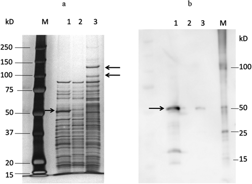 Figure 2. SDS-PAGE and immunoblot analysis of sonicates of T. denticola ATCC 35405, DMSP3, and K1. SDS-PAGE analysis (a) and immunoblot analysis (b).