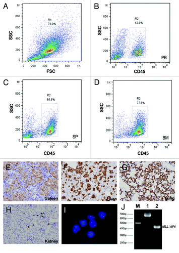Figure 2. Evaluation of ALL engraftment in NOD/SCID mice at the endpoint. (A–D) Representative results from the FACS analysis of a NOD/SCID mouse transplanted with pro-B-ALL (case ALL-5). (A) The total nucleated cell population was gated on the basis of light scattering properties (FSC/SSC). Cells from the peripheral blood (B), spleen (C) and bone marrow (D) were stained with FITC-conjugated anti-human CD45 to calculate the percentage of human cells (hCD45+ %). (E–H) Representative results from IHC staining of the same mouse. Deparaffinized sections of the spleen (E), liver (F), lung (G) and kidney (J) were stained with anti-human CD45RB antibody (original magnification × 400). (I) FISH analysis of the infiltrated blasts. Cells were detected with a fluorescence-labeled probe and counterstained with DAPI. The probe used was p17H8, which is specific for centromeric repeat sequences on human chromosome 17. Only engrafted human cells will present two green signals, whereas the cells from mouse will not. (J) Nested PCR analysis of MLL/AF4 fusion transcript for the detection of xenotransplantation in the pro-B-ALL model (derived from case ALL-5, carrying MLL/AF4). The internal positive control E2A (690 bp) and amplified product (~450 bp) are shown in lanes 1 and 2, respectively.