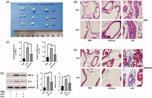 Figure 1. The effect of curcumin on prostate size and expression of inflammatory cytokines in mice. (A) Representative images of the size of mouse prostate in each group. (B) Representative images of different tissues stained with H&E (top panel: 200× magnification, bar = 50 μm; bottom panel: 400× magnification, bar = 50 μm). (C,D) PCR and western blotting analyses of TNF-α and IL-6 in primary mice prostate epithelial cells. *p < 0.05. (E) Representative images of different tissues dyed with Masson's trichrome staining (top panel: 200× magnification, bar = 50 μm; bottom panel: 400× magnification, bar = 50 μm).