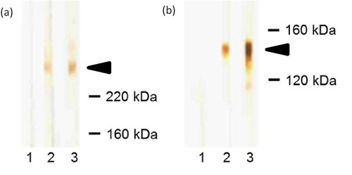 Figure 9. Western blotting. (a) Western blot with dermal extract. 1, blood donor; 2, positive control; 3, EBA patient; arrow indicates the migration position of type VII collagen. (b) Western blot with recombinant NC1 domain of type VII collagen. 1, blood donor; 2, positive control; 3, EBA patient; arrow indicates the migration position of NC1 domain.