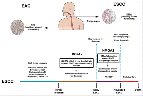 Figure 1. HMGA involvement in esophageal carcinogenesis. As shown by Palumbo Júnior et al., 2016, HMGA proteins are differentially induced in esophageal cancer, depending on the histolopathological tumor type. HMGA2, but not HMGA1, is overexpressed in esophageal squamous cell carcinoma (ESCC) and its mRNA levels discriminate ESCC from tumor surrounding mucosa, pointing out its potential role as an ESCC early diagnostic marker. In addition, HMGA2 abrogation is capable of reverting ESCC malignant phenotype, revealing HMGA2 as an innovative target for ESCC cancer therapy, as shown in the figure ilustrating ESCC progression accross time (Adpated from Meireles Da Costa et al., 2013 – reference Citation8). Conversely, HMGA1, but not HMGA2, is overexpressed in esophageal adenocarcinoma (EAC).