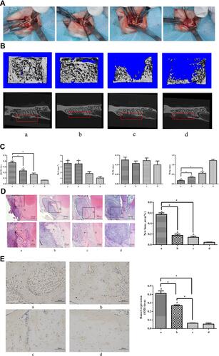 Figure 1 Micro-CT and histological analysis of bone regeneration in periodontal bone defect in vivo. The rats were randomly divided into four groups: (a) collagen membranes with rat BMSCs were implanted into the defects, and the rats were injected with CORM-3 intraperitoneally; (b) collagen membranes were implanted into the defects, with CORM-3 injection intraperitoneally; (c) collagen membranes with rat BMSCs were implanted into the defects, and then the rats were injected with 0.9% sodium chloride solution intraperitoneally; (d) collagen membranes were implanted into the defects, with 0.9% sodium chloride solution injection intraperitoneally. (A) Photographs of the general surgical procedure. (B) The longitudinal Micro-CT images (upper panel) and transverse X-ray image (lower panel). Red frames were used to show the defect region with regeneration. (C) The quantitative analysis of the newly formed bone by CT analysis software. (D) H&E staining images of the newly formed bone under different magnifications. The staining image with the whole bone defect zone was labeled by the black dot line and the newly formed bone by the red dot line. The area within the black square was magnified and shown in the lower panel. “D” indicates the dentin. The black asterisk indicates the newly formed bone. The quantitative analysis of the newly formed bone by H&E staining was calculated using Image-Pro Plus 6.0 software. (E) Immunohistological images of newly formed bone by immunohistochemical staining of Runx2. Quantitative analyses of Runx2 expression using Image-Pro Plus 6.0 software. ^ P<0.05 vs control; * P<0.05 as indicated.