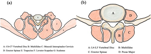 Figure 2. The sectional anatomy of paraspinal muscles at cervical (a) and lumbar (b) spine.