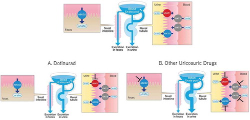 Figure 1. Comparison of the potency of selective urate reabsorption inhibitors and other uricosuric drugs. (upper) The usual state of urate handling. (A) SURI selectively inhibits URAT1, leading to a potent reduction of the urate pool. (B) Other uricosuric drugs inhibit URAT1 and ABCG2 and/or OAT1/3. Arrow width indicates the amount of urate