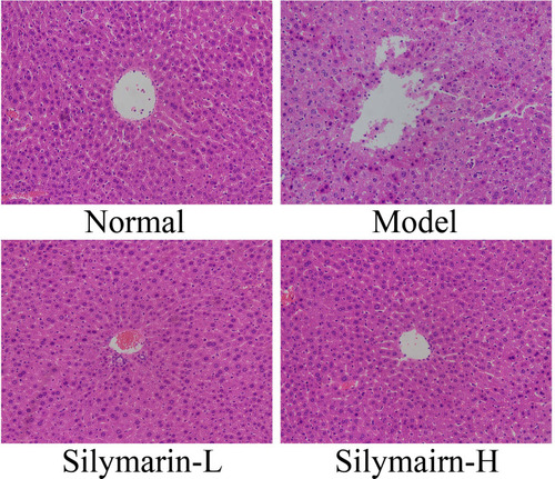 Figure 2 H&E pathological staining structure of liver tissues. Model: treated with D-Gal/LPS (30 mg/kg·bw/3 μg/kg·bw) intraperitoneal injection; silymarin-L: treated with silymarin (75 mg/kg·bw) intragastric administration; silymarin-H: treated with silymarin (150 mg/kg·bw) intragastric administration.