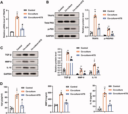 Figure 3. Influence of asiaticoside on the TRAF6/NF-κB activity in osteosarcoma cells. M2 phenotype macrophages induced by IL-4/IL-13 were co-cultured with osteosarcoma cells, and the cells were treated with 40 μM ATS for 24 h. (A) The TRAF6 mRNA level in U2OS cells was determined using qRT-PCR. (B) The protein levels of TRAF6, Total P65, and p-P65 were measured by Western blot, and the quantification of TRAF6 and p-P65/P65. (C) Analysis of TGF-β, MMP-9, and IL-10 protein levels using Western blot, and the quantification of TGF-β, MMP-9, and IL-10 protein levels was displayed. (D) The contents of TGF-β, MMP-9, and IL-10 in the supernatant of U2OS cell culture were detected by enzyme-linked immunosorbent assay (ELISA). *p < 0.05, **p < 0.01 vs. control. #p < 0.05 vs. co-culture. Each assay was conducted in triplicate.