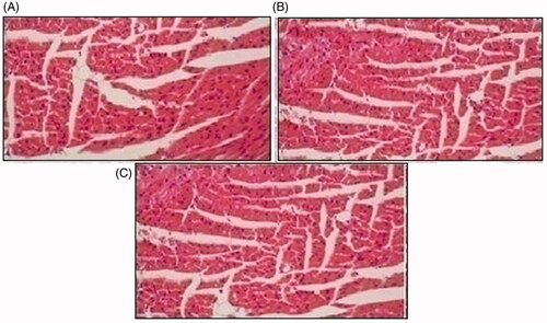 Figure 14. Histological slides of heart of rabbit of control group I (A), after oral solution of 5-FU-MMWCH-NPs treated group II (B) and 5-FU-MMWCH-NPs treated group III (C).