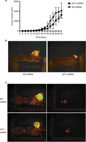 Figure 5 Effect of GIT1 on primary osteosarcoma growth and lung metastasis in the orthotopic model.Notes: OST cells infected with GIT1-shRNA or NC-shRNA were orthotopically transplanted into the distal femur of nude mice and allowed to form tumors. (A) Tumor diameter was evaluated for 45 days. (B) The representative fluorescence imaging of orthotopic tumor in two groups. The independent Student’s t-test for comparing tumor volume between NC-shRNA and GIT1-shRNA group was conducted in different post-implantation days. (C) The representative fluorescence imaging of lung metastasis in two groups. Left column: the images of whole mice; right column: the images of lung metastasis (*P<0.05).