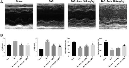 Figure 1. Andr reduces cardiac dysfunction in vivo. (A) Representative M-mode echocardiography of left ventricular chamber in the sham, TAC, TAC + Andr 100 mg/kg and TAC Andr 200 mg/kg groups. (B) Quantification of echocardiography parameters of left ventricular-end-systolic diameter (LVESD), left-ventricular-end diastolic diameter (LVEDD), LV ejection fraction (EF) and LV shortening score (FS) at different groups of mice. **p < 0.01 and ***p < 0.001 vs. the sham group; #p < 0.05, ##p < 0.01 and ###p < 0.001 vs. the TAC group.