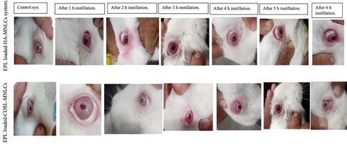 Figure 6 Photographs showing normal rabbit eyes after instillation of 0.1 mL physiological saline in a control eye, Epl loaded HA-MNLCs, and Epl loadedCOSL-MNLCs (instillation repeated every hour for 6 hours).